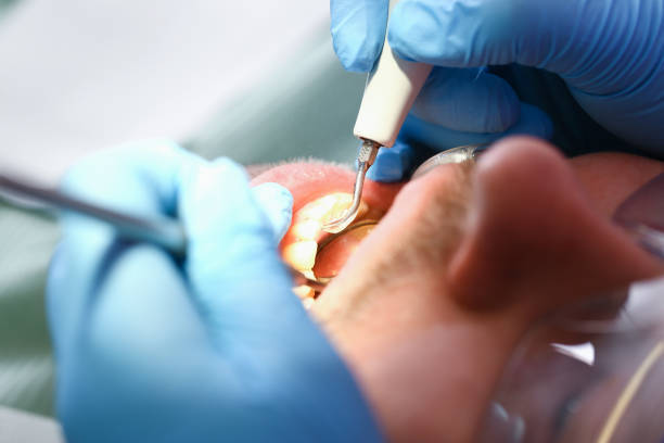 Best Broken or Cracked Tooth Emergency Dentist in Monticello, FL